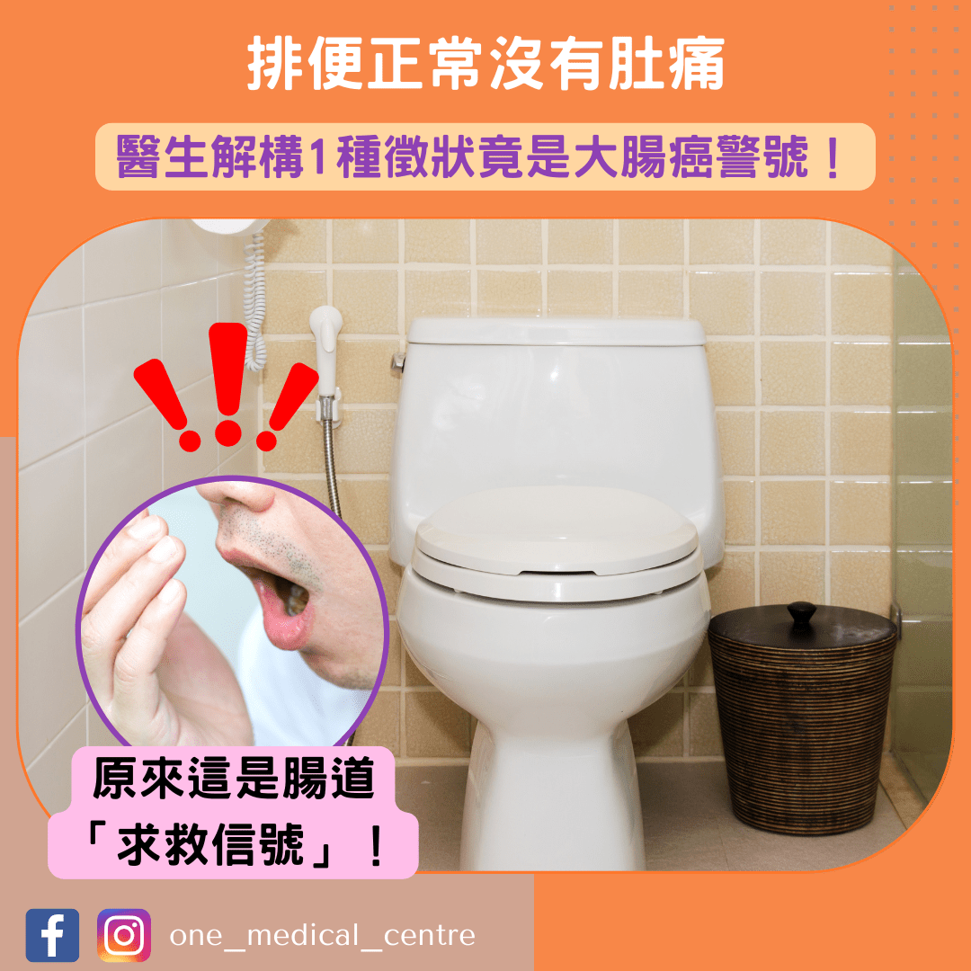 【排便正常沒有肚痛　醫生解構1種徵狀竟是大腸癌警號】